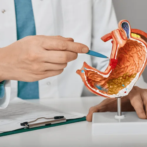 Manejo Integral de la Distensión Abdominal en el Estado de México