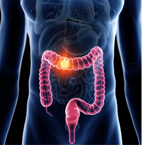 ¿Qué especialista trata el dolor abdominal crónico?