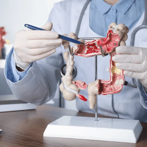 Especialistas en el Diagnóstico y Tratamiento de Gastritis en el Estado de México