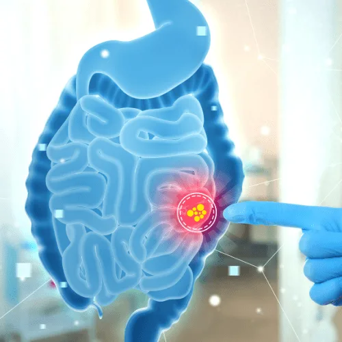 ¿Qué especialista trata la pancreatitis?